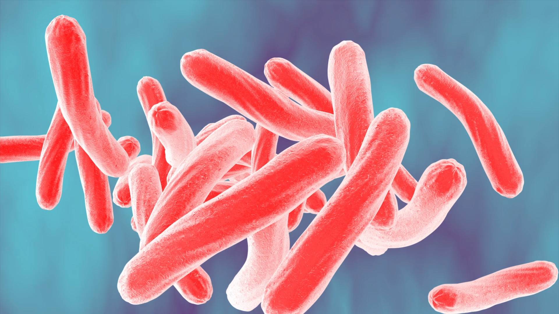 Understanding sickle cell disease