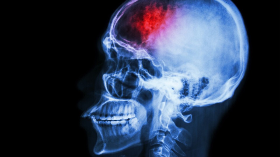 Nearly 40 percent of people have fictional first memory, study says